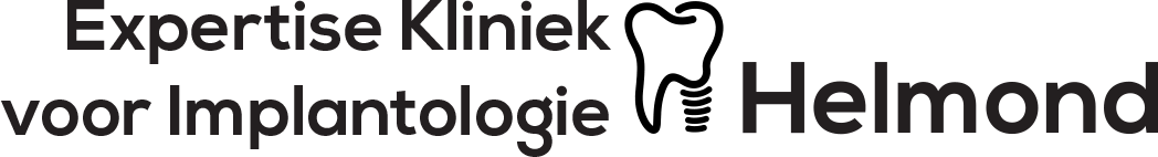 Expertise Kliniek voor Implantologie Helmond